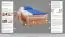 Single bed / Storage bed K1/1n "Easy Premium Line" incl. 2 drawer and cover plates, clearly varnished - 90 x 200 cm 